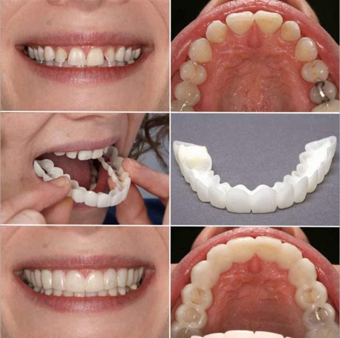 Smile Fit Flex Cosmetic Denture Teeth