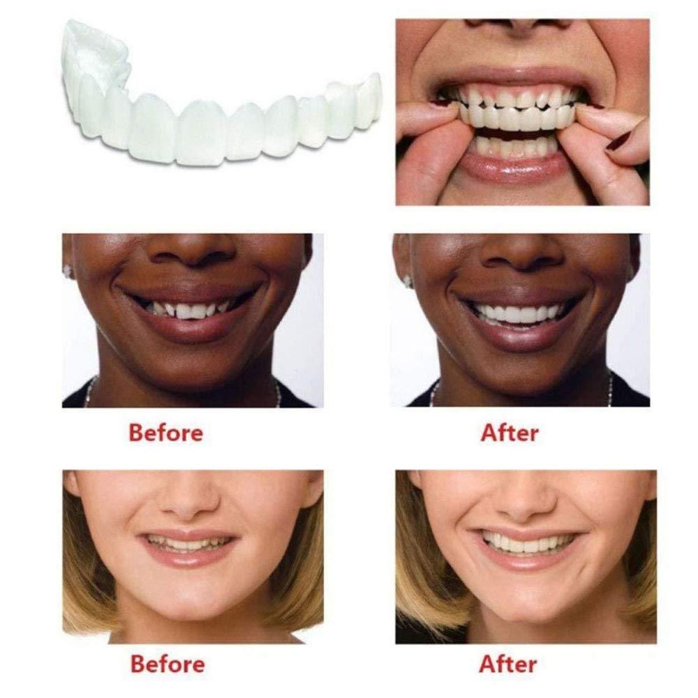 Smile Fit Flex Cosmetic Denture Teeth